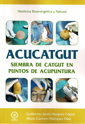 Libro Acucatgut. Siembra De Catgut En Puntos De Acupuntur...
