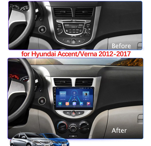 Autoradio Android Hyundai Accent 2011-2020 4+64gb 8core Foto 2
