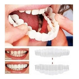 Snap On Smile Superior E Inferior Prótesis Dentadura Postiço