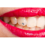 Strass Dental X 24 + 1 Mariposa + Corazones X3