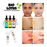 Retinoico 40% 50ml +peeling 3d 100ml +tca 50ml +sabonete