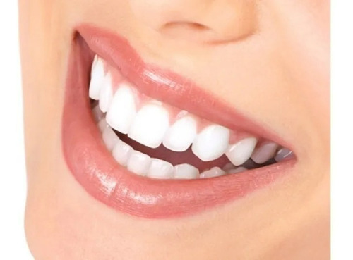 Piercing Dental Cristal Odontología X10 Unidades