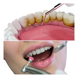 Limpieza Dental Con Ultrasonido+fluor. Remoción De Sarro.