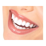 Piercing Dental Cristal Odontología 10 Unidades