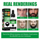 Aceite Esencial Para Barba Que Engrosa Rápidamente  30 Ml