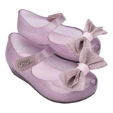 Sapatilha Infantil Melissa Baby Sweet Xii Top Menina