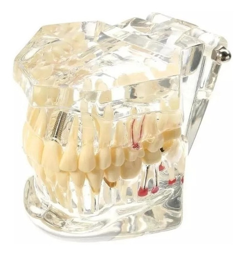 Manequim Modelo Molde Dentário Dental Boca Transparente