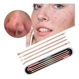 4 Curetas Extrator Removedor Limpeza De Cravos Acne Espinhas