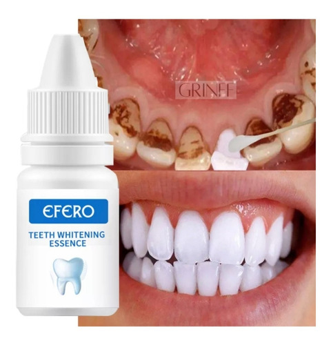 Branqueador Dental Sem Mancha Promoção -  Sorriso Perfeito!