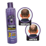 Dom Pelo Shampoo Nixidil 250 Ml 