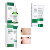 Kit Acido Salicílico Antiacne 