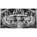 Radiografía Panorámica Dental
