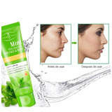 Exfoliante Peeling Gel Elimina La Piel Muerta De Menta