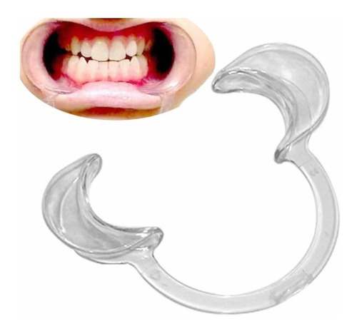  Abre Boca Dental Cheek Oral Retractil Gengivitis Odontologi