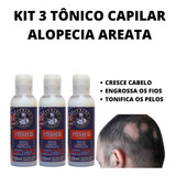 Kit 3 Loção Alopecia Areata Nasce Cresce E Fortalece Unissex