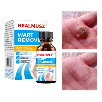 Líquido Para Verrugas 30 Ml-reparación Eficaz | MercadoLibre