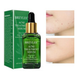 Serum Tratamiento Para Acne Pieles Grasas 100% Efectividad Tipo De Piel Grasa