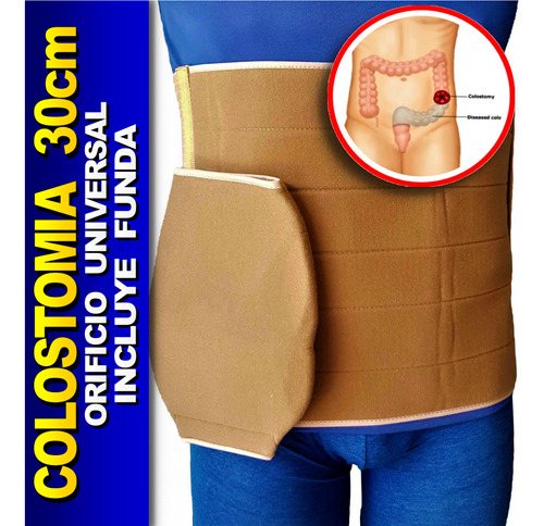 30 Cm Faja Colostomia Ileostomia + Funda Unitalla