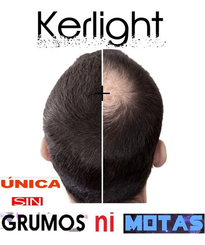 Promoción 30gr+10 Gratis (gr $ 1.112) Fibra Capilar Kerlight