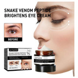 Eye Delights Aumenta Suero Eliminar Ojeras Arrugas 4975