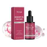 Aceite De Rosa Mosqueta Para Rostro 10 Ml