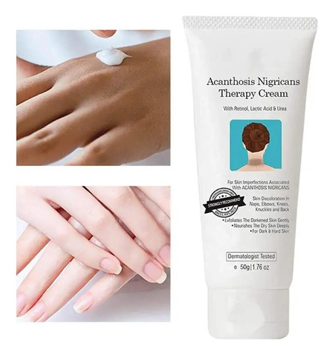 Corrector De Manchas De Acantosis Nigricans En Crema Negra