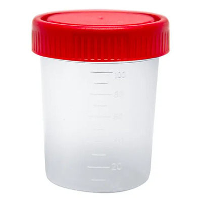 Vaso Recolector De Orina 100ml Estéril 50 Piezas Labvoisier | MercadoLibre