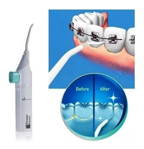 Limpiador Dental Bucal Jet Power Floss Hilo Dental Oferta