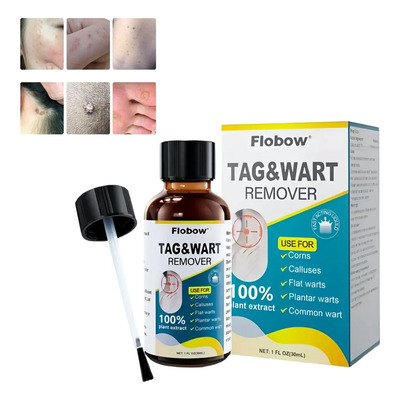 Líquido Para Verrugas 30 Ml - Eliminación Rápida | MercadoLibre