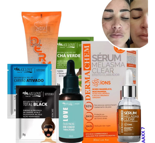 Melasma  Kit Facial Tira Manchas Escuras 