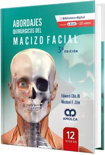 Abordajes Quirúrgicos Del Macizo Facial. 3a Edición
