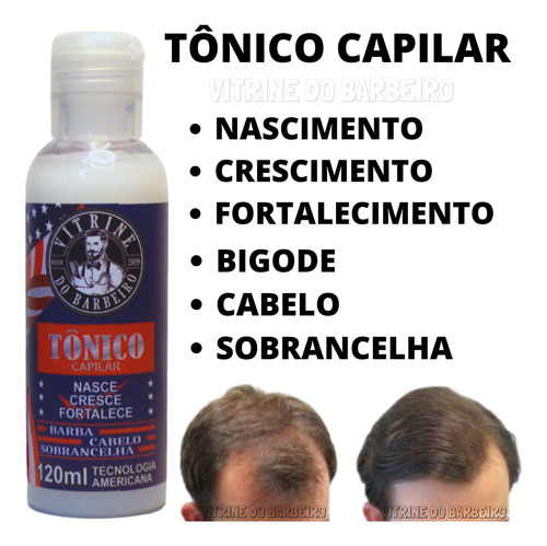 Tônico Masculino Feminino Nasce Cresce Fortalece Cabelo Top!