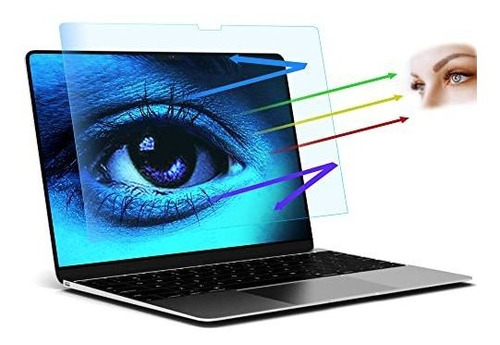 Filmext Protector De Pantalla Para Macbook Pro De 14 Pulgada