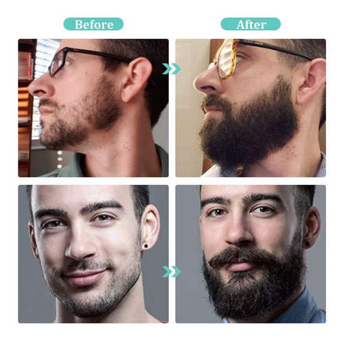 Kit De Crecimiento De Barba Párrafo Regalos Para Hombres, Ki