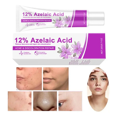 Crema Para El Acné Que Contiene Ácido Azelaico | MercadoLibre