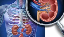 Tratamiento De Enfermedades Renales Y Hepáticas