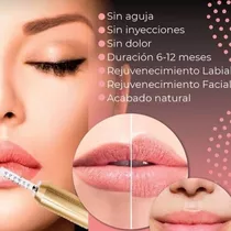 Relleno De Labios Con Hyaluron Pen