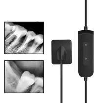 Sensor Raio-x Periapical Digital Odontologia Endodontia 12x