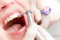 Busco Pacientes Para Limpieza Dental Y Restauraciones.