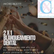 Blanqueamiento Dental 2x1!!!!! No Te Lo Pierdas !!