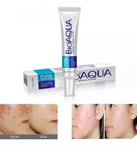 Bioaqua Acné Cream, Elimina Acné, Marcas De Acne 