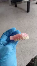 Servicio De Laboratorio Dental Retenendores 