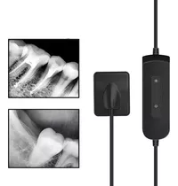 Sensor Raio X Periapical Digital Odontologia Endodontia 