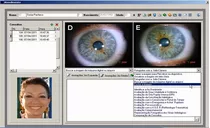 Irismake Iridologia E Terapias Software-curso De Utilização