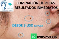 Eliminacion De Pecas