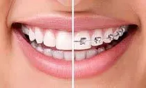 Dentista, 096014768, Odontólogo. Prótesis, Brackets