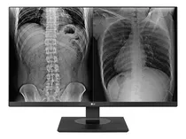 Monitor LG 27inc. 27hj713c-b Ips 8mp Clinical Tc