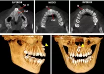 Rayos X General Tomografía Y Panorámica Dental Odontologia 
