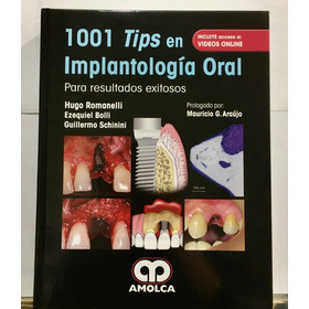 1001 Tips En Implantología Oral Romanelli