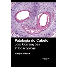 Livro Patologia Do Cabelo Com Correlações Tricoscópicas, 1ª Edição 2023, De Miteva, Mariya. Editora Dilivros, Capa Dura, Edição 1 Em Português, 2023